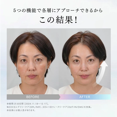 ミライワン　EMSの効果